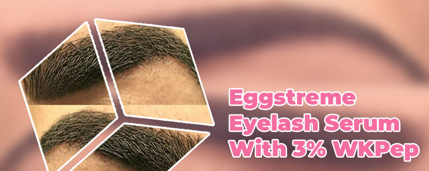 Does almond oil grow eyelashes