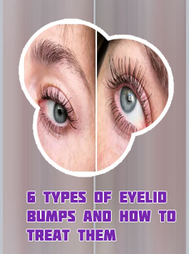 Toplash dermatologist recommended eyelash serum